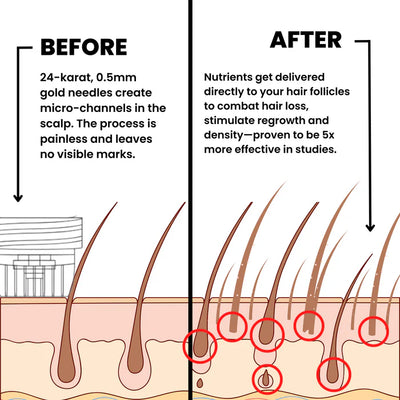 Phyne | Hair Regrowth System