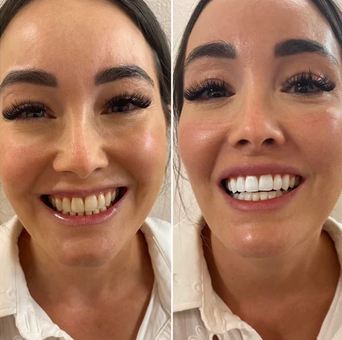 Customer result for Emma L.